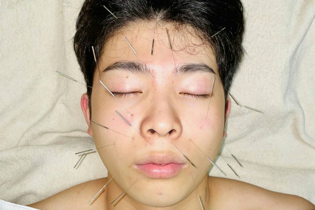 思春期の男性針